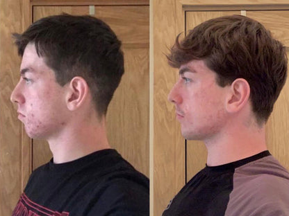 Ultimate Mouth Tape for Jawline Enhancement & Better Breathing